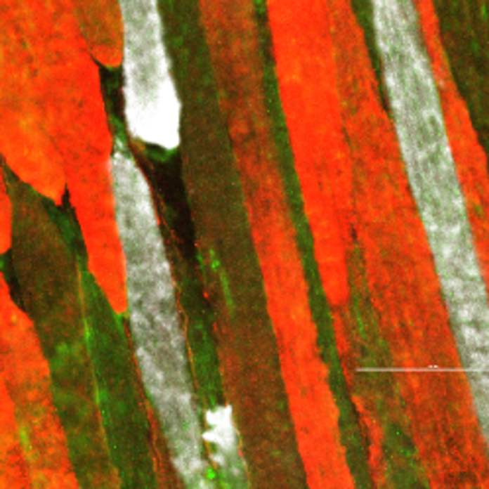 Different mouse muscle fibers, which are long and arranged vertically, are stained in green, red, and white