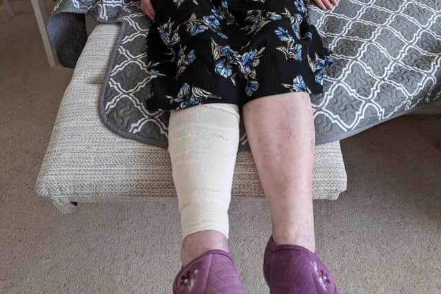 Brenda still needs to see doctors weekly to have her injuries treated. Photo: Submitted