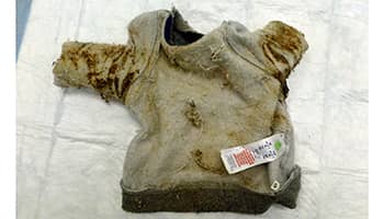 Gruby baby jumper used to cover up dog's skin condition © RSPCA