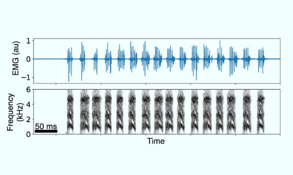 Trill electromyographic activity recorded during sleep and synthetic sounds generated by the dynamical model. Image credit: Döppler et al., doi: 10.1063/5.0194301.