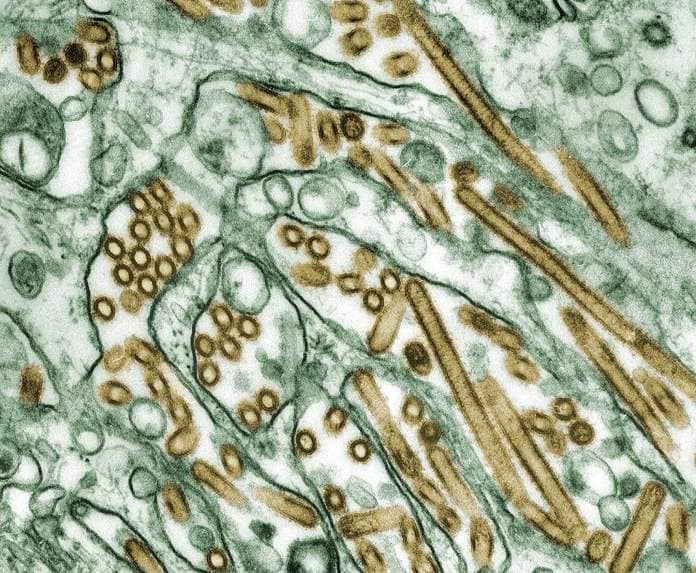 PHOTO: A colorized transmission electron micrograph depicts Avian influenza A H5N1 viruses (seen in gold) grown in MDCK cells (seen in green). 